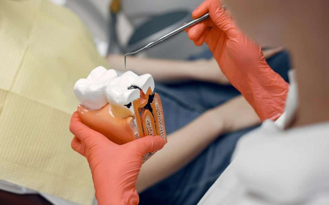 Endodoncia en Donostia y Arrasate: cómo salvar un diente con infección
